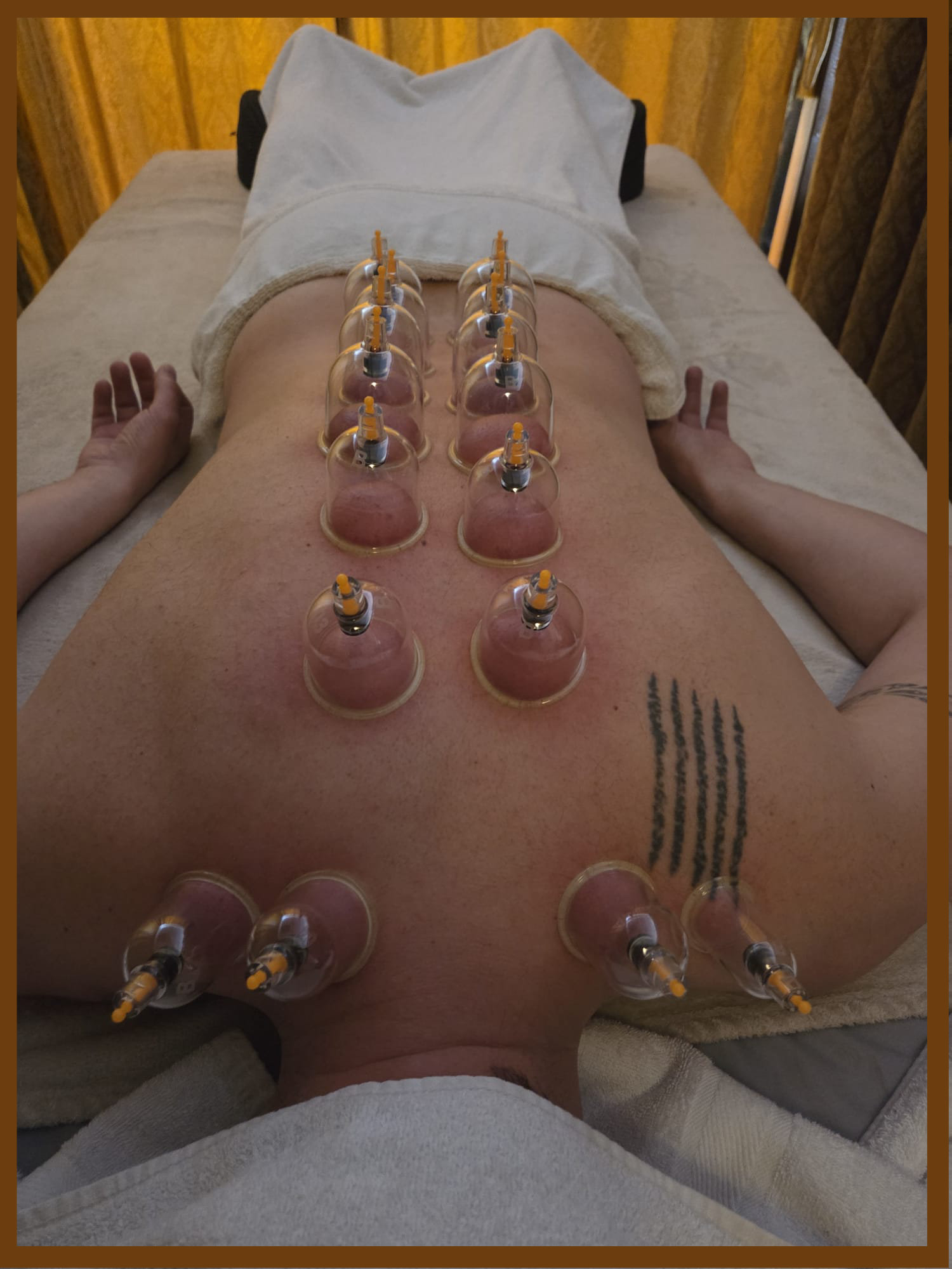 Cupping Massage in Spijkenisse bij Zentara